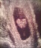 My Bby At 8 Weeks n 1 Day x