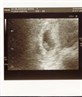 My Baby's 1st Scan-7Weeks & 1Day.x