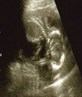 mi lil baby boy! scan pic on 10/02/09