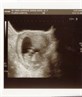 Our Baby At 12Weeks & 3Days :) x