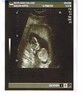 my scan