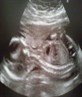 Our Lil Girl At 20 Weeks & 6 Days :) xxx