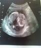 ma sis's scan photo awww
