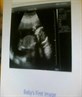 20 week scan...our baby boy :) <3