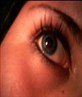 my eye